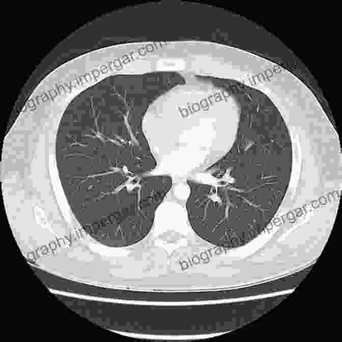 A Computed Tomography (CT) Scan Of The Human Chest Databases For Biosignals And Bioimages: MRI CT Mammography Ultrasound