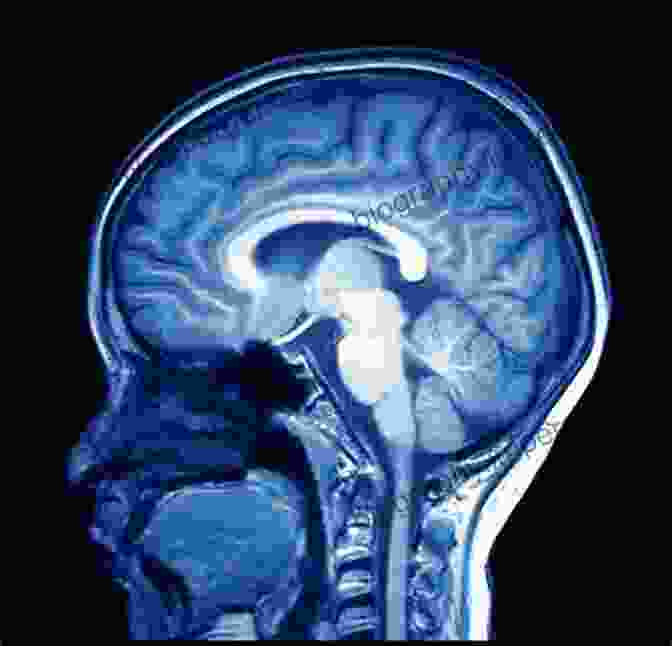 A Magnetic Resonance Imaging (MRI) Scan Of The Human Brain Databases For Biosignals And Bioimages: MRI CT Mammography Ultrasound