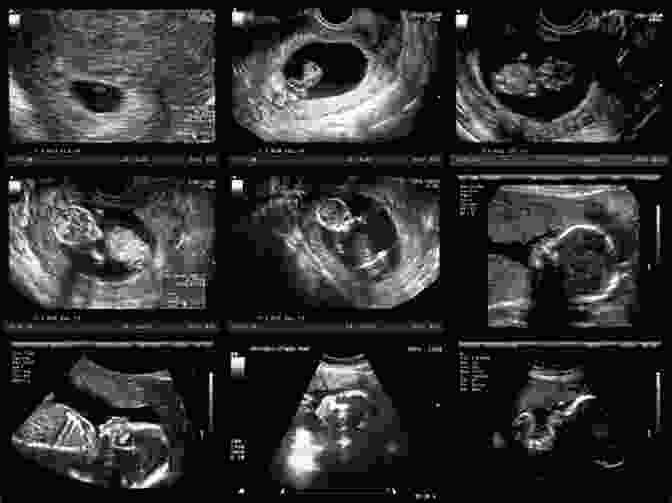 An Ultrasound Image Of A Human Fetus Inside The Uterus Databases For Biosignals And Bioimages: MRI CT Mammography Ultrasound