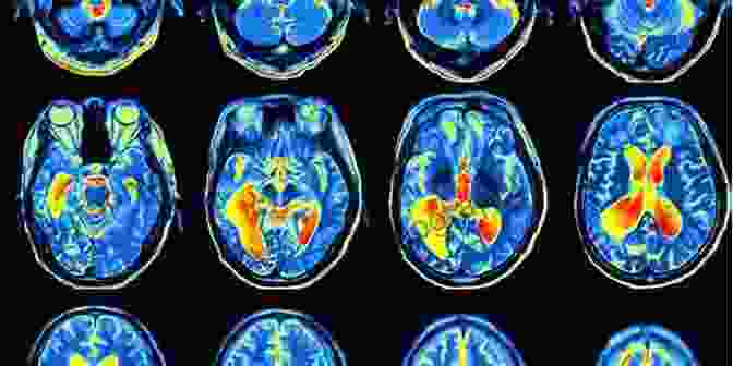 Brain Scan Showing Regions Activated During Anger Handbook Of Anger Management And Domestic Violence Offender Treatment