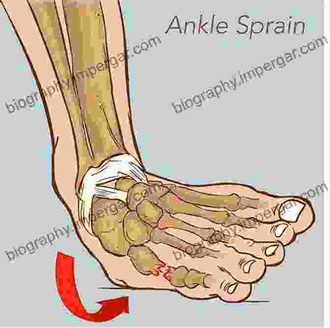 Image Of A Person Treating An Ankle Sprain First Aid Fundamentals: A Step By Step Illustrated Guide To The Top 10 Essential First Aid Procedures Everyone Should Know (Self Sufficient Survival)