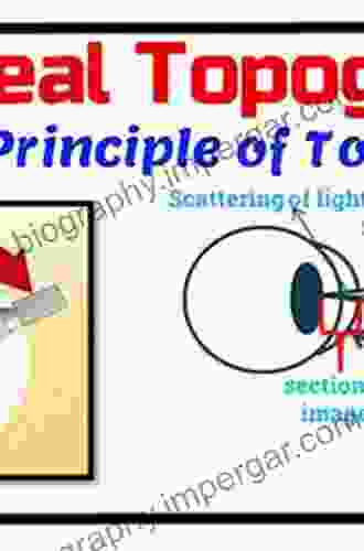 Corneal Topography: Principles and Applications