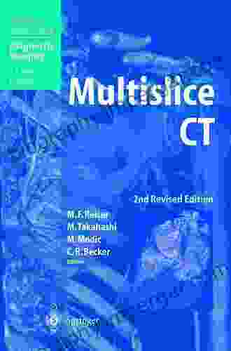 Multislice CT (Medical Radiology)