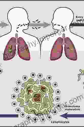 Pathogenesis Of Mycobacterium Tuberculosis And Its Interaction With The Host Organism (Current Topics In Microbiology And Immunology 374)