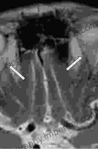 Post Treatment Imaging Of The Orbit