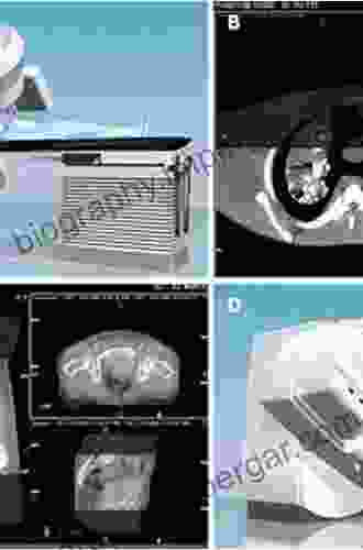 Principles And Practice Of Image Guided Radiation Therapy Of Lung Cancer (Imaging In Medical Diagnosis And Therapy)