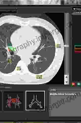 Sectional Anatomy By MRI And CT E