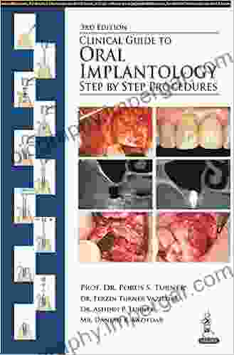 Clinical Guide To Oral Implantology: Step By Step Procedures