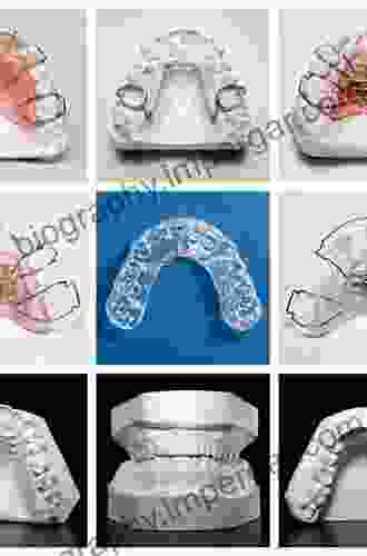 Twin Block Functional Therapy: Applications In Dentofacial Orthopedics