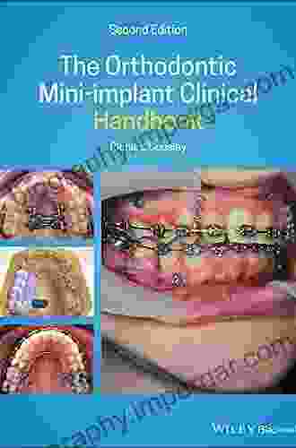 The Orthodontic Mini Implant Clinical Handbook